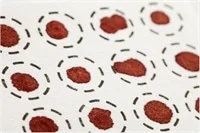 DNA Sexing; Blood on Paper