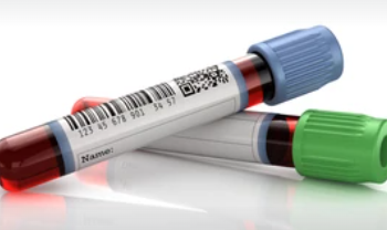 Mareks Antigen Testing
